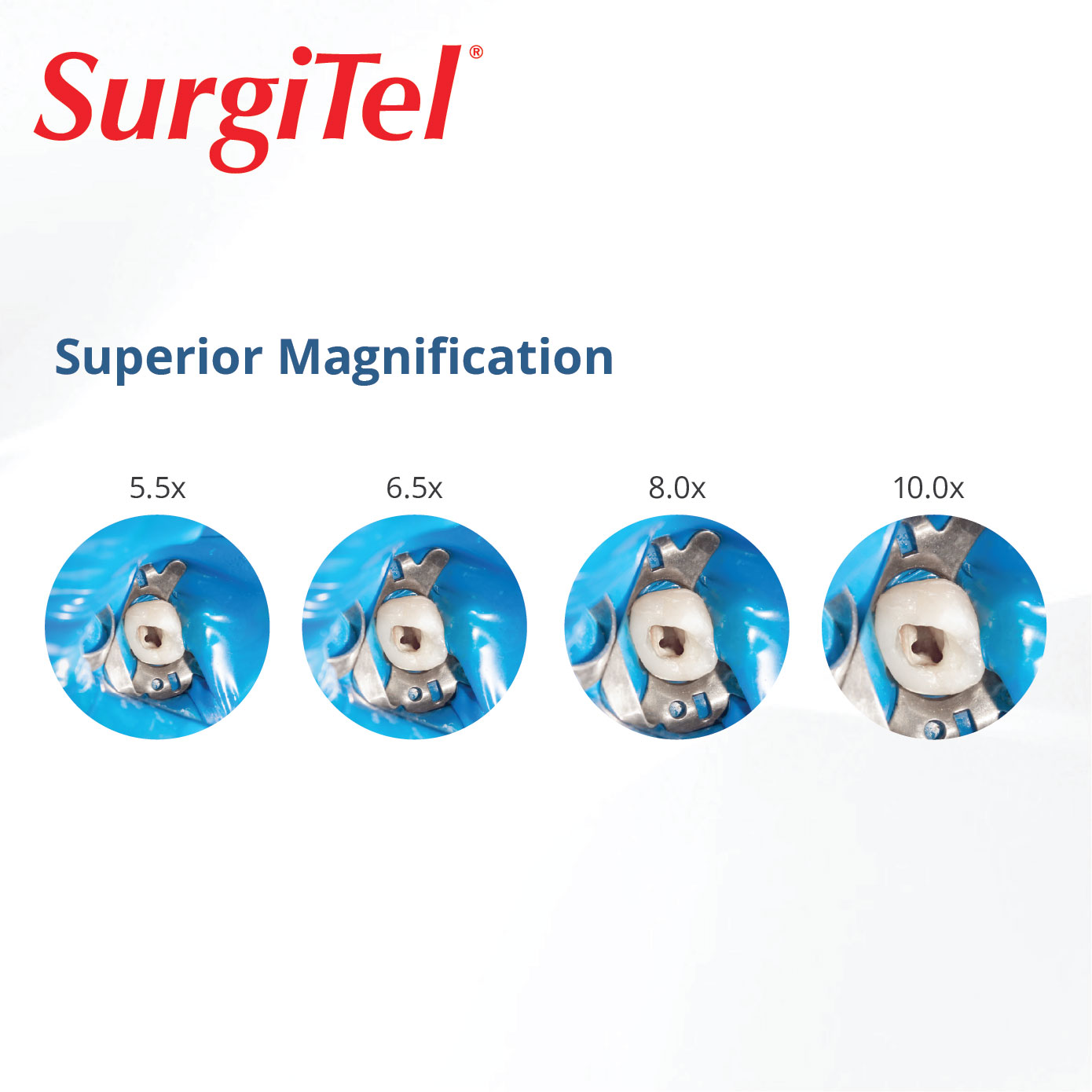 SurgiTel Prism Pro Loupes - Image 2